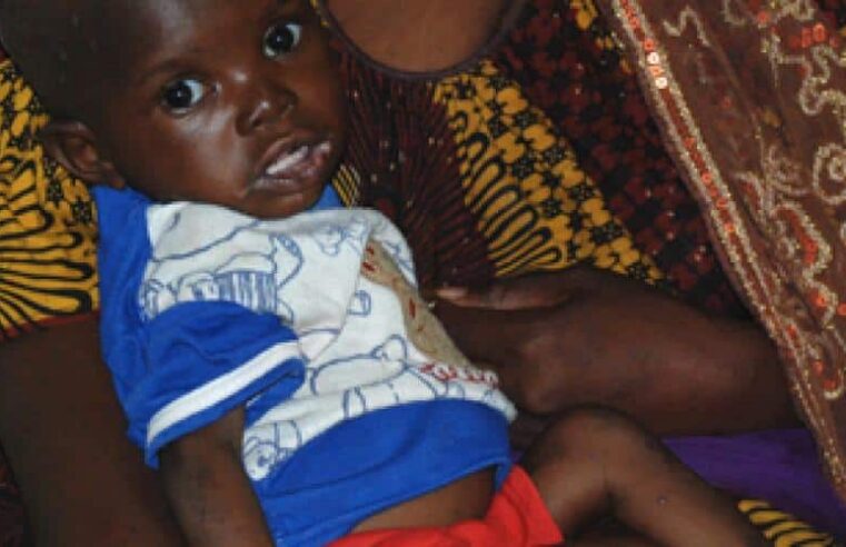 Crise de la malnutrition au Mali : enjeux et solutions pour les familles