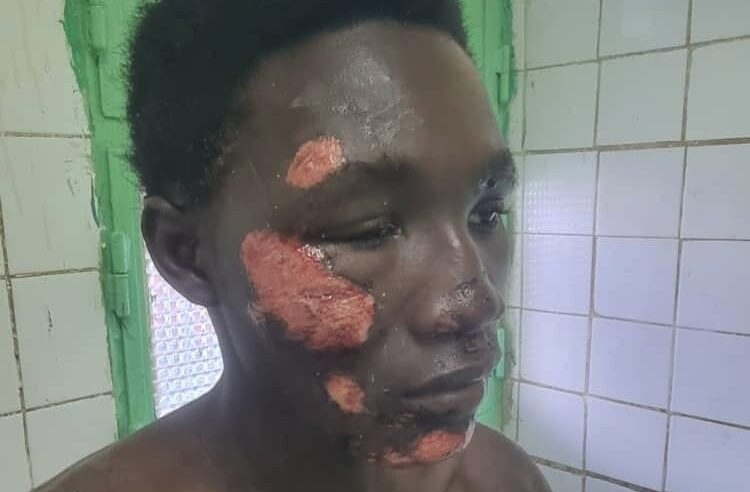 Sécurité au Tchad : un père exige des réponses après une agression près du camp 27