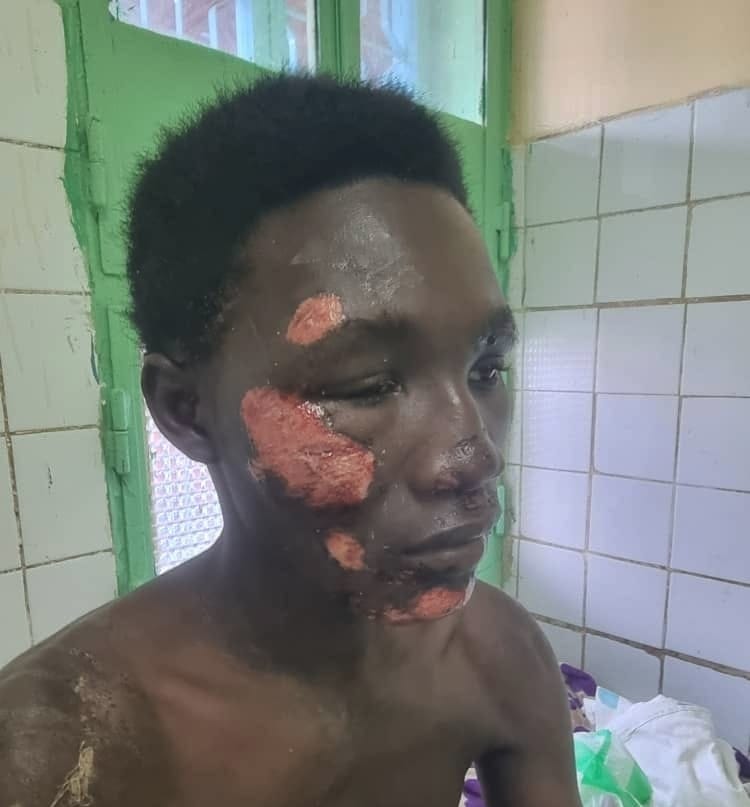 Sécurité au Tchad : un père exige des réponses après une agression près du camp 27